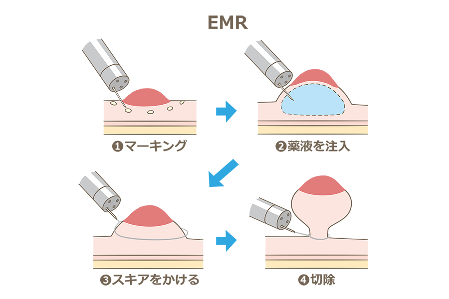 EMR