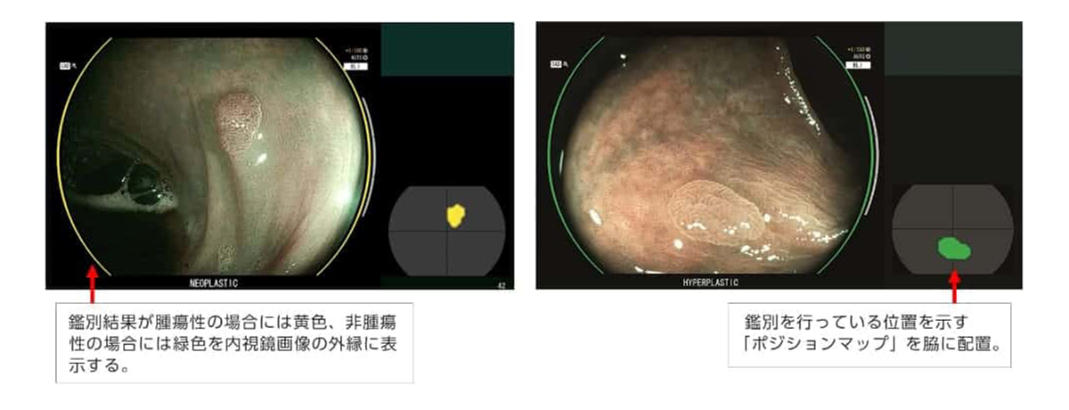疾患鑑別支援機能の画面