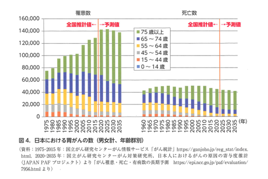 日本における胃がんの数