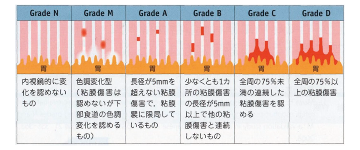 胃食道逆流症（GERD）の分類