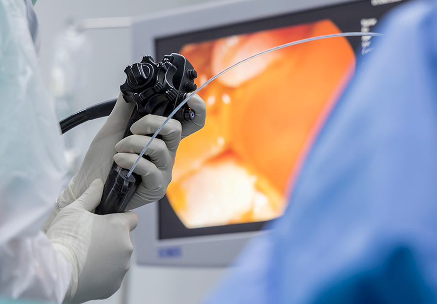 大腸カメラ検査