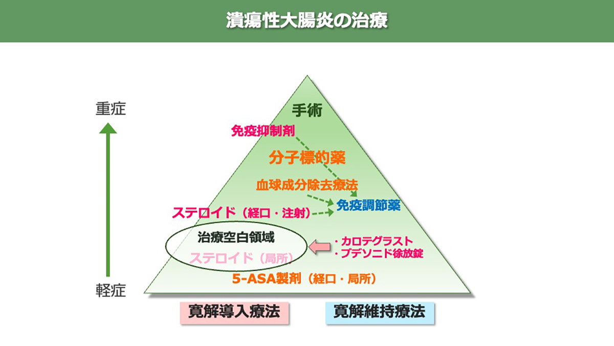 潰瘍性大腸炎の治療
